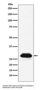 Anti-Carbonic anhydrase 2 Rabbit Monoclonal Antibody