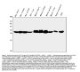 Anti-CA2 Antibody Picoband® (monoclonal, 10E11)