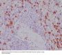 Anti-CD11b ITGAM Rabbit Monoclonal Antibody