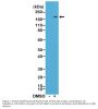 Anti-CD11b (integrin alpha-M) ITGAM Rabbit Monoclonal Antibody, Clone#RM290