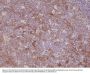 Anti-CD11b (integrin alpha-M) ITGAM Rabbit Monoclonal Antibody, Clone#RM290