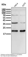 Anti-p21 CDKN1A Rabbit Monoclonal Antibody