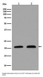 Anti-p21 CDKN1A Rabbit Monoclonal Antibody