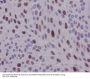 Anti-Cyclin D1 CCND1 Rabbit Monoclonal Antibody