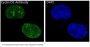 Anti-Cyclin D1 CCND1 Rabbit Monoclonal Antibody