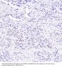 Anti-Cyclin D1 CCND1 Rabbit Monoclonal Antibody