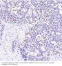 Anti-Cyclin D1 CCND1 Rabbit Monoclonal Antibody