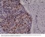 Anti-Cyclin D1 (CCND1) Rabbit Monoclonal Antibody, Clone#RM241