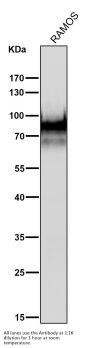 Anti-CD19 Rabbit Monoclonal Antibody