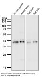 Anti-CCR2/CKR2 Rabbit Monoclonal Antibody