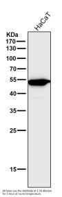Anti-CCR2/CKR2 Rabbit Monoclonal Antibody