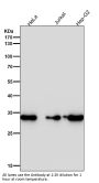 Anti-CDK4 Rabbit Monoclonal Antibody