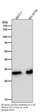 Anti-CDK4 Rabbit Monoclonal Antibody