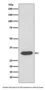 Anti-CDK4 Rabbit Monoclonal Antibody