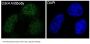Anti-CDK4 Rabbit Monoclonal Antibody