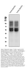 Anti-SLC2A1 Antibody Picoband® (monoclonal, 10C10)