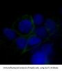 Anti-GLUT1 SLC2A1 Rabbit Monoclonal Antibody