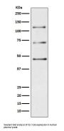 Anti-Complement C3 Monoclonal Antibody