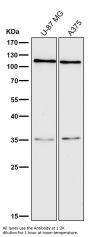 Anti-C3/Complement C3 Rabbit Monoclonal Antibody