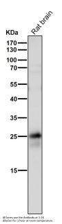 Anti-p27 KIP 1 CDKN1B Rabbit Monoclonal Antibody