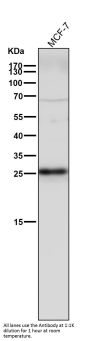 Anti-p27 KIP 1 CDKN1B Rabbit Monoclonal Antibody