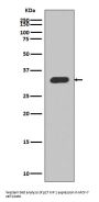 Anti-p27 KIP 1 CDKN1B Rabbit Monoclonal Antibody