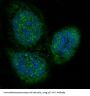 Anti-p27 KIP 1 CDKN1B Rabbit Monoclonal Antibody