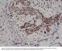 Anti-p27Kip1 (Cyclin-dependent kinase inhibitor 1B) CDKN1B Rabbit Monoclonal Antibody, Clone#RM302