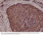 Anti-p38 MAPK MAPK14 Rabbit Monoclonal Antibody, Clone#RM245