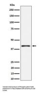 Anti-Phospho-p38 (T180) Rabbit Monoclonal Antibody