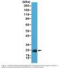 Anti-Caveolin-1 CAV1 Rabbit Monoclonal Antibody, Clone#RM325