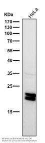 Anti-Caveolin-1 CAV1 Rabbit Monoclonal Antibody