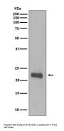 Anti-Caveolin-1 CAV1 Rabbit Monoclonal Antibody