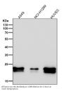 Anti-Caveolin-1 CAV1 Rabbit Monoclonal Antibody