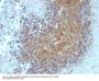Anti-Bax (Apoptosis Marker) Monoclonal Antibody