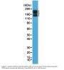 Anti-CD56 NCAM1 Rabbit Monoclonal Antibody, Clone#RM315