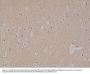 Anti-CD56 NCAM1 Rabbit Monoclonal Antibody, Clone#RM315