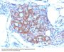 Anti-CD56 / NCAM1 (Neuronal Cell Marker) Monoclonal Antibody