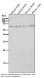 Anti-TRAF6 Rabbit Monoclonal Antibody