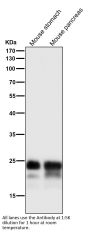 Anti-MUC1 Rabbit Monoclonal Antibody