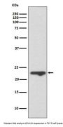 Anti-MUC1 Rabbit Monoclonal Antibody