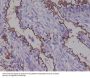 Anti-MUC1 Rabbit Monoclonal Antibody