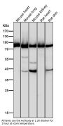 Anti-Argonaute 2 AGO2 Rabbit Monoclonal Antibody
