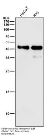Anti-MHC class I HLA-A Rabbit Monoclonal Antibody