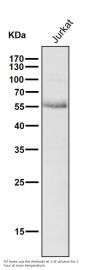 Anti-Wilms Tumor Protein WT1 Rabbit Monoclonal Antibody