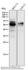 Anti-Wilms Tumor Protein WT1 Rabbit Monoclonal Antibody