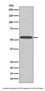 Anti-Wilms Tumor Protein WT1 Rabbit Monoclonal Antibody