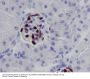 Anti-Wilms Tumor Protein WT1 Rabbit Monoclonal Antibody