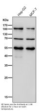 Anti-FGFR3 Rabbit Monoclonal Antibody