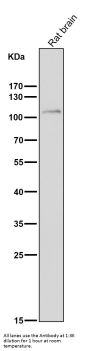 Anti-FGFR3 Rabbit Monoclonal Antibody